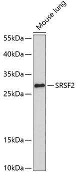 SRSF2 Rabbit polyclonal antibody