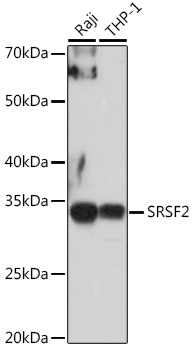 SRSF2 Rabbit polyclonal antibody