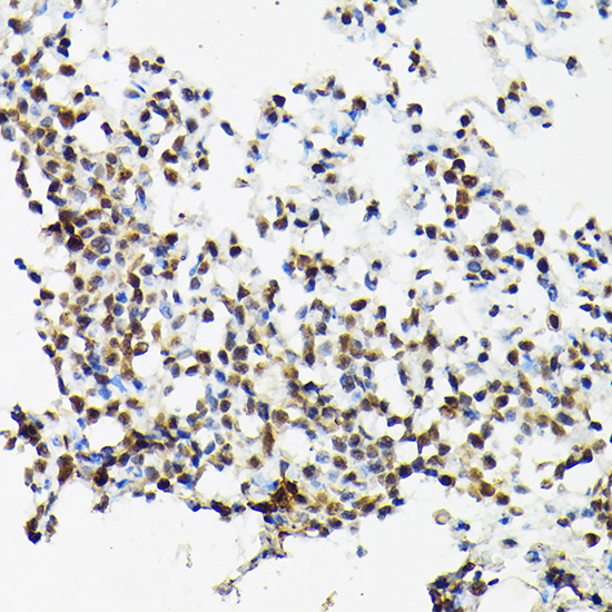 SRSF2 Rabbit polyclonal antibody