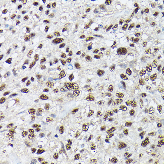 SRSF2 Rabbit polyclonal antibody