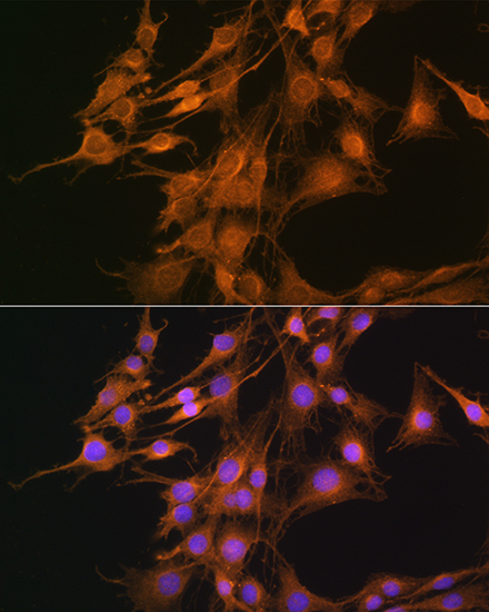 ELOVL4 Rabbit polyclonal antibody