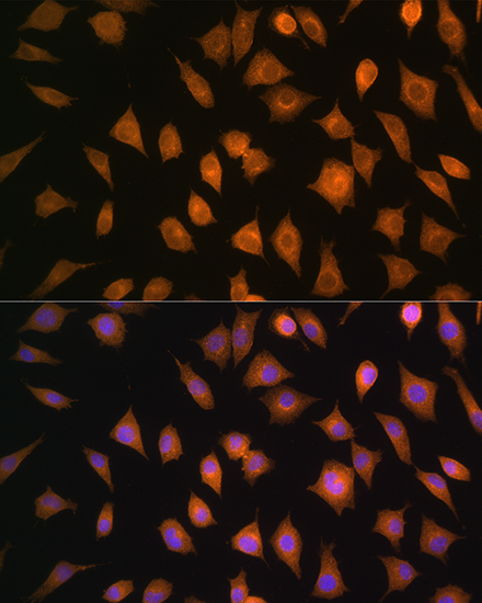 ELOVL4 Rabbit polyclonal antibody