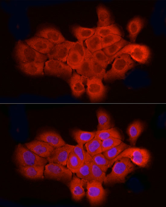 ELOVL4 Rabbit polyclonal antibody