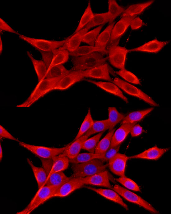 ELOVL4 Rabbit polyclonal antibody