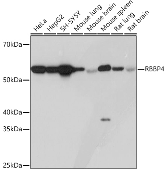 RBBP4 Rabbit monoclonal antibody
