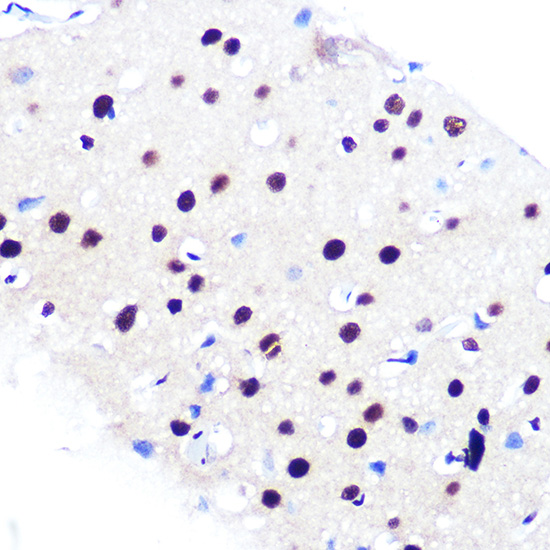 RBBP4 Rabbit monoclonal antibody