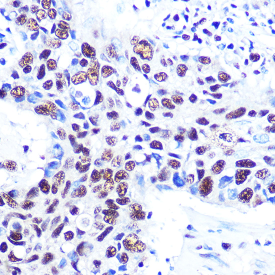 RBBP4 Rabbit monoclonal antibody