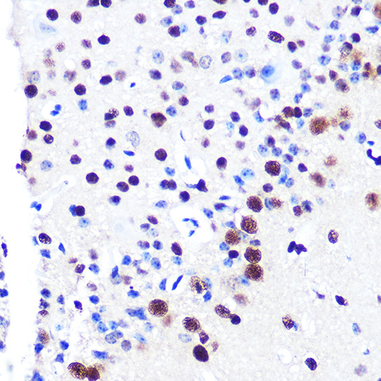 RBBP4 Rabbit monoclonal antibody