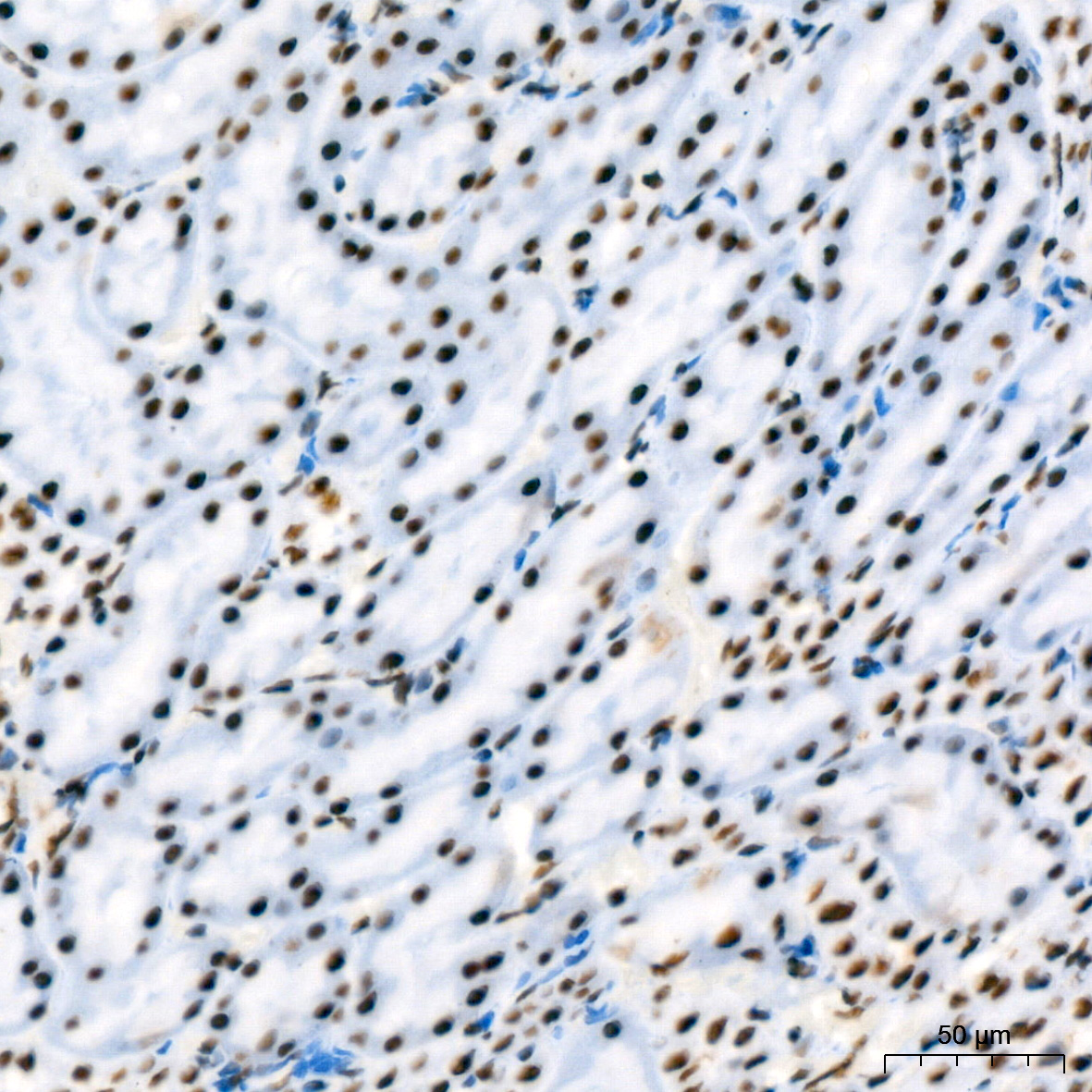 RBBP4 Rabbit monoclonal antibody