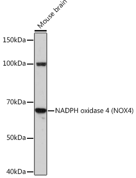NADPH oxidase 4 (NOX4) Rabbit mAb
