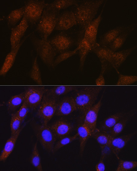 PSMD4 Rabbit monoclonal antibody