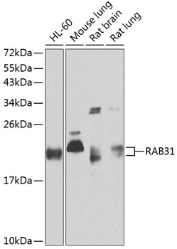 RAB31 Rabbit polyclonal antibody