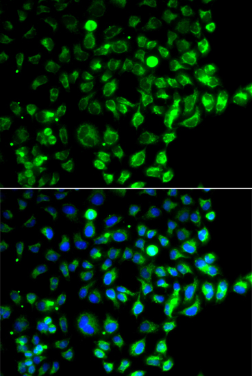 RAB31 Rabbit polyclonal antibody