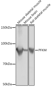 PFKM Rabbit monoclonal antibody
