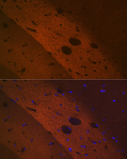 mGluR2 Rabbit monoclonal antibody