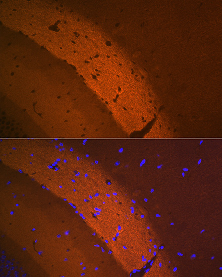 mGluR2 Rabbit monoclonal antibody