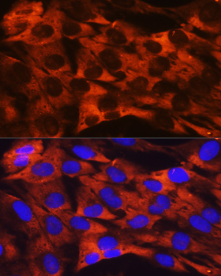 RPS19 Rabbit monoclonal antibody