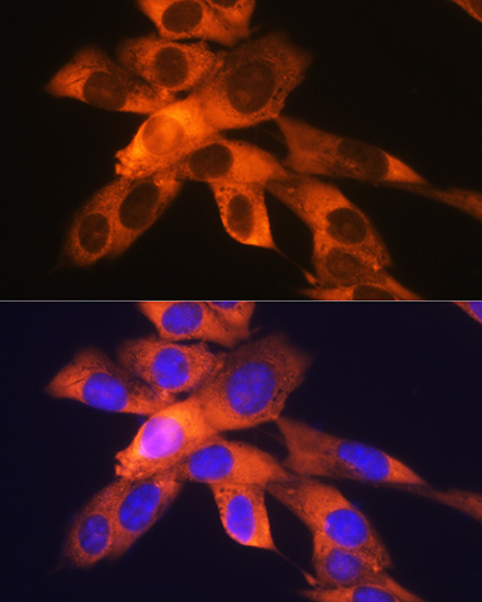 RPS19 Rabbit monoclonal antibody