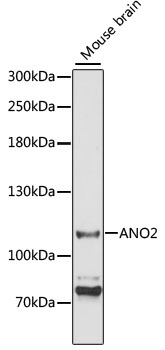 ANO2 Rabbit polyclonal antibody