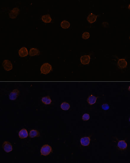 ANO2 Rabbit polyclonal antibody
