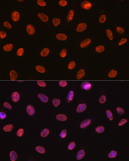 U1A/SNRPA Rabbit monoclonal antibody