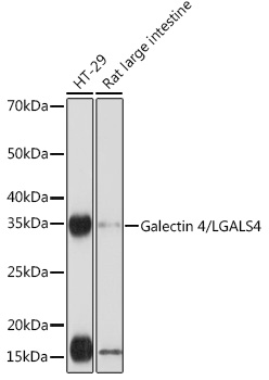 Galectin 4/LGALS4 Rabbit monoclonal antibody
