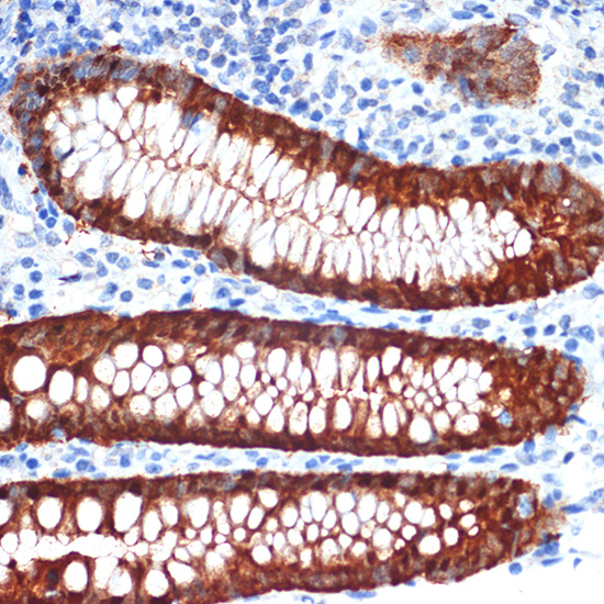 Galectin 4/LGALS4 Rabbit monoclonal antibody