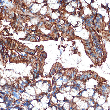 Galectin 4/LGALS4 Rabbit monoclonal antibody