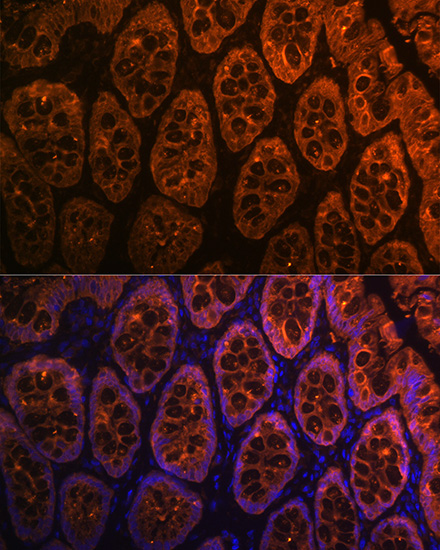 Galectin 4/LGALS4 Rabbit monoclonal antibody