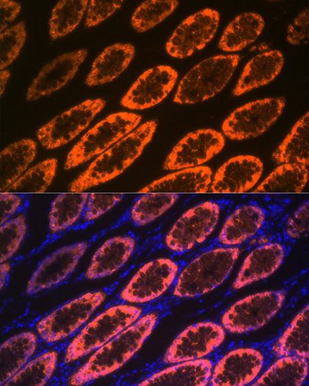 Galectin 4/LGALS4 Rabbit monoclonal antibody