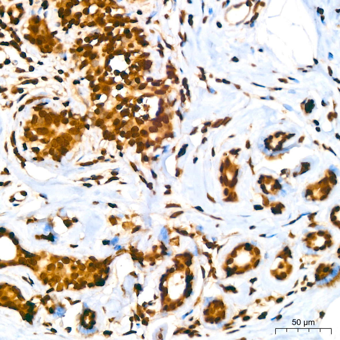 Histone H2A Rabbit monoclonal antibody