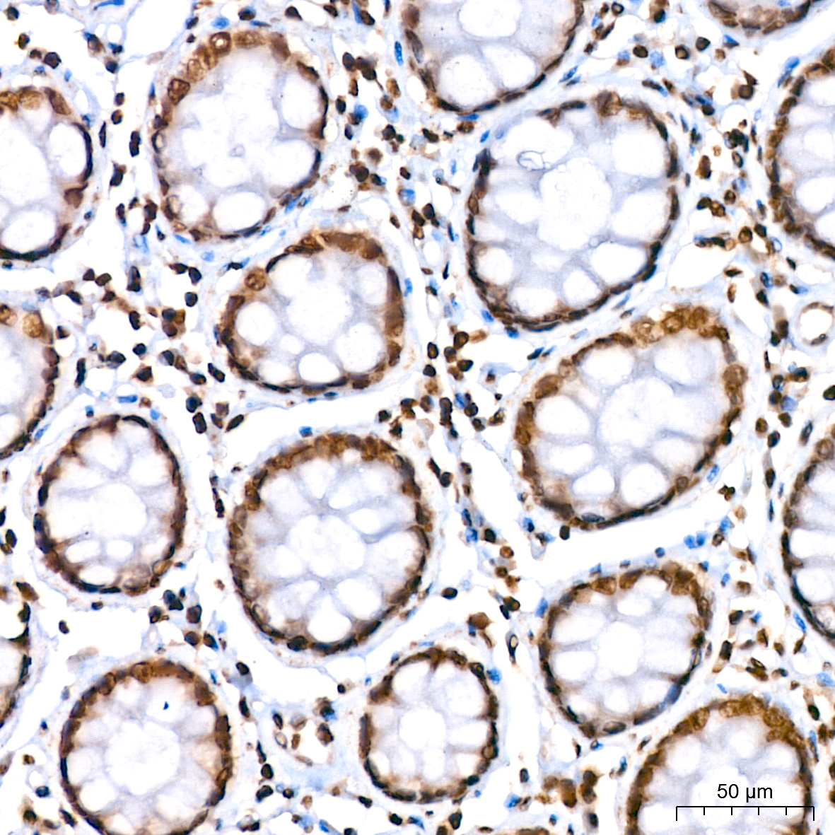 Histone H2A Rabbit monoclonal antibody