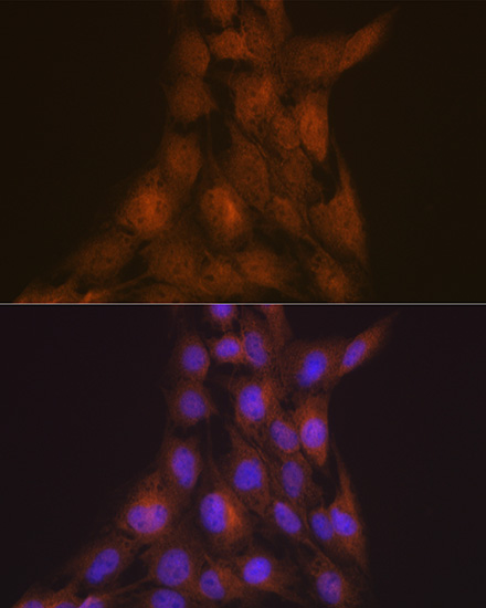 LIS1 Rabbit monoclonal antibody