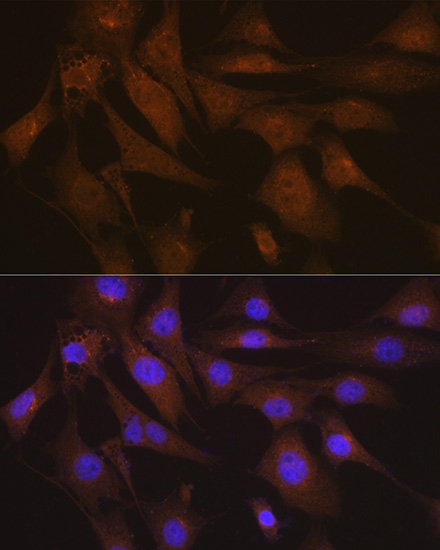 LIS1 Rabbit monoclonal antibody