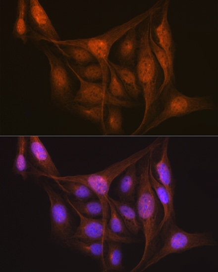 LIS1 Rabbit monoclonal antibody