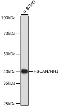 [KO Validated] HIF1AN/FIH1 Rabbit monoclonal antibody