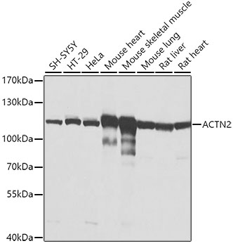 ACTN2 Rabbit polyclonal antibody