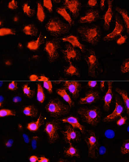 ACTN2 Rabbit polyclonal antibody