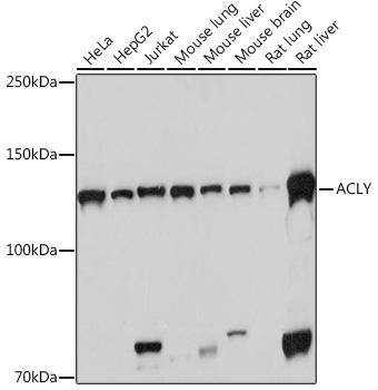 [KO Validated] ACLY Rabbit monoclonal antibody