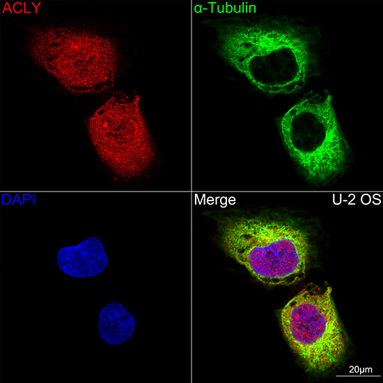 [KO Validated] ACLY Rabbit monoclonal antibody