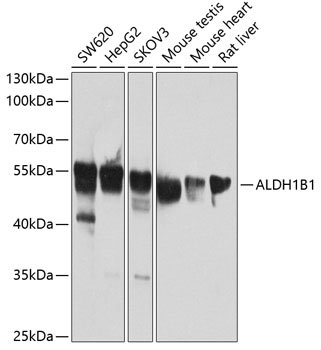 ALDH1B1 Rabbit polyclonal antibody