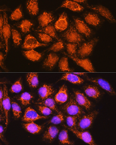 ALDH1B1 Rabbit polyclonal antibody