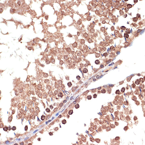 BANF1 Rabbit monoclonal antibody