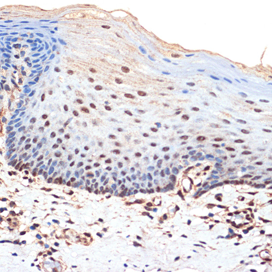 BANF1 Rabbit monoclonal antibody