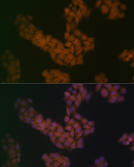 BANF1 Rabbit monoclonal antibody