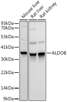 ALDOB Rabbit polyclonal antibody