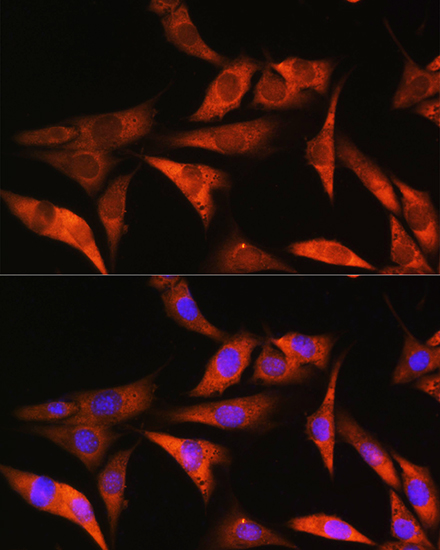 ALDOB Rabbit polyclonal antibody