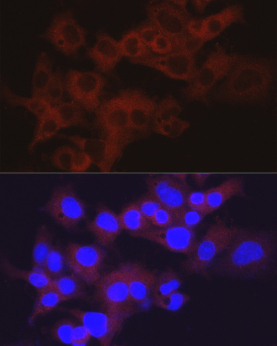 ALDOB Rabbit polyclonal antibody