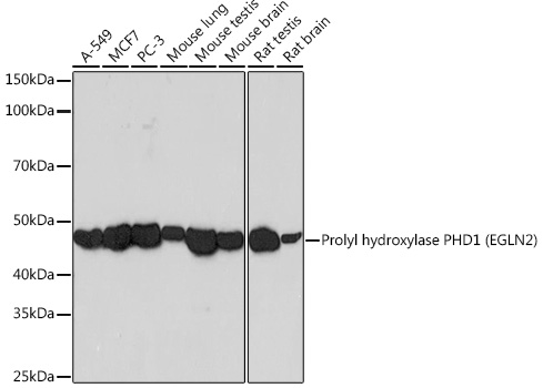 Prolyl hydroxylase PHD1 (EGLN2) Rabbit mAb