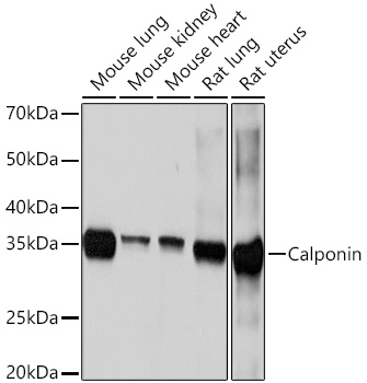 Calponin Rabbit monoclonal antibody